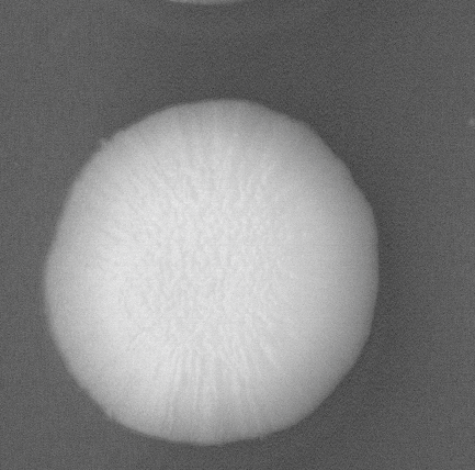 CCM_YPD_img