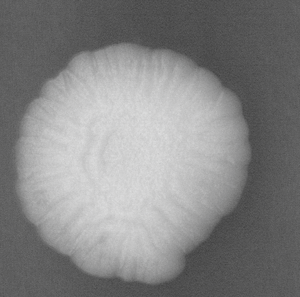 CCM_YPD_img